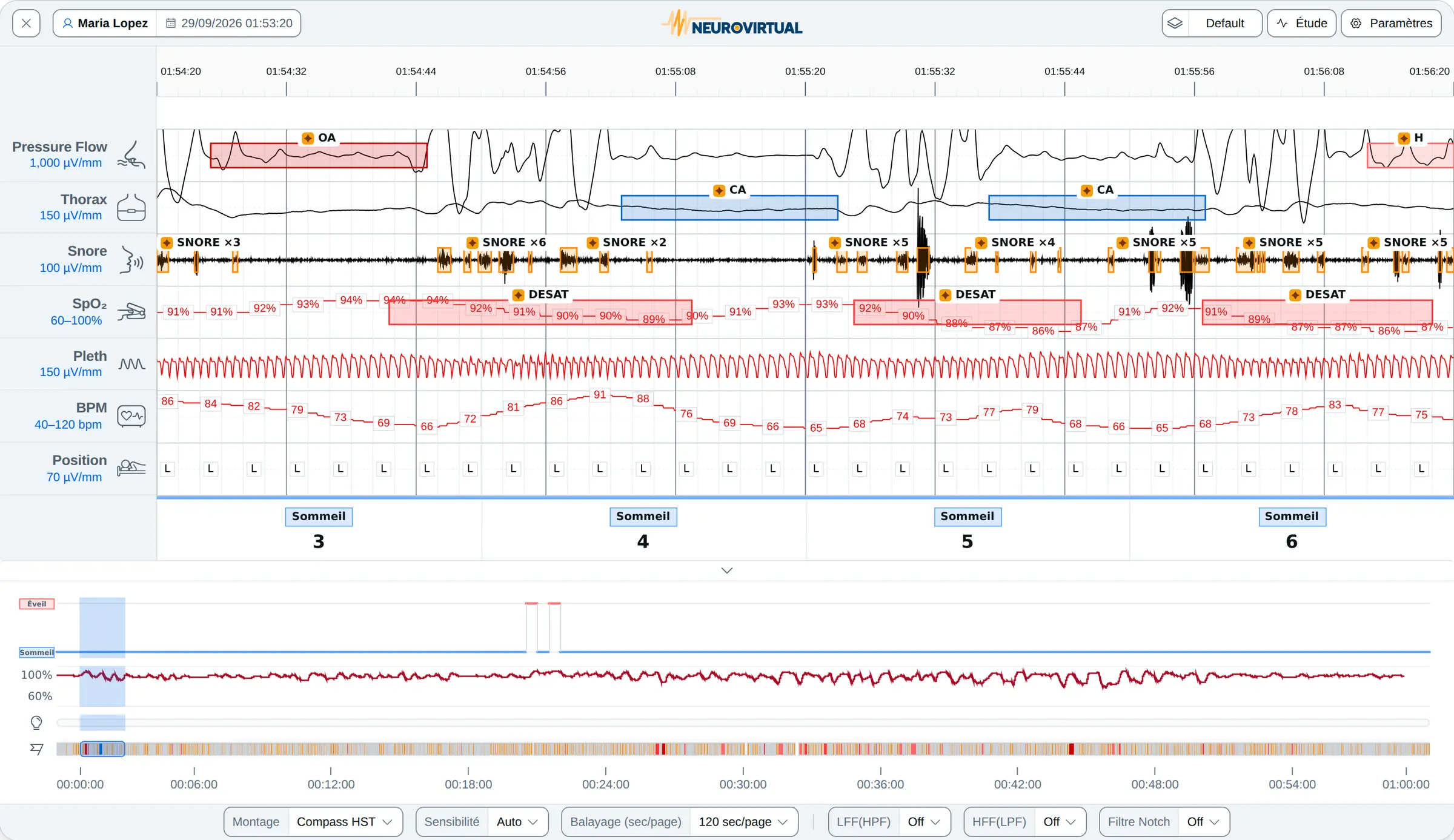 Deux minutes d’un enregistrement du HST Compass dans le visualiseur de tracés : débit par pression, effort thoracique, ronflement, SpO₂, pléthysmographie, fréquence du pouls et position corporelle, avec les événements cotés, l’hypnogramme et la tendance SpO₂ de toute la nuit